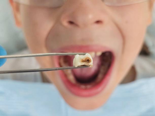 Best 24-Hour Emergency Dentist in West Liberty, IA